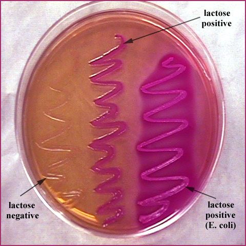 MacConkey agar