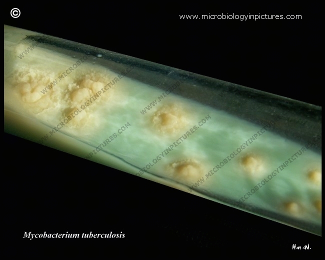 Löwenstein-Jensen Medium