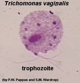 Trichomoniasis