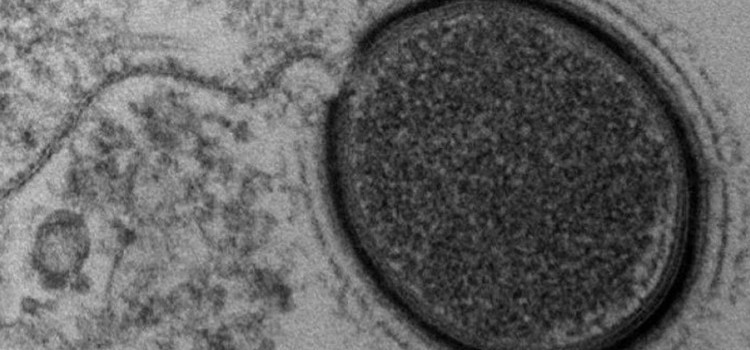 Sibirya’da Keşfedilen Donmuş Virüs Uyandırılıyor