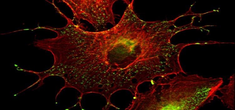Melanoma Başlangıcında Embriyonik Kimliğin Yeniden Ortaya Çıkması