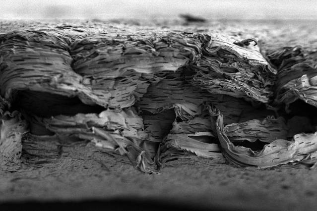 Vücudun Yeniden Kemik Üretebilmesini Sağlayan Bir Kemik İskelesi Üretildi!