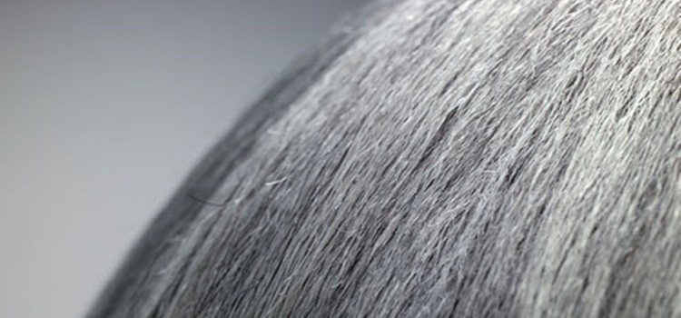 Saçlar neden beyazlıyor?