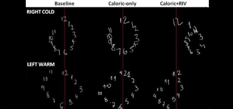 Büyük ve Küçük Sayılar Beynin Farklı Yarıkürelerinde İşleniyor