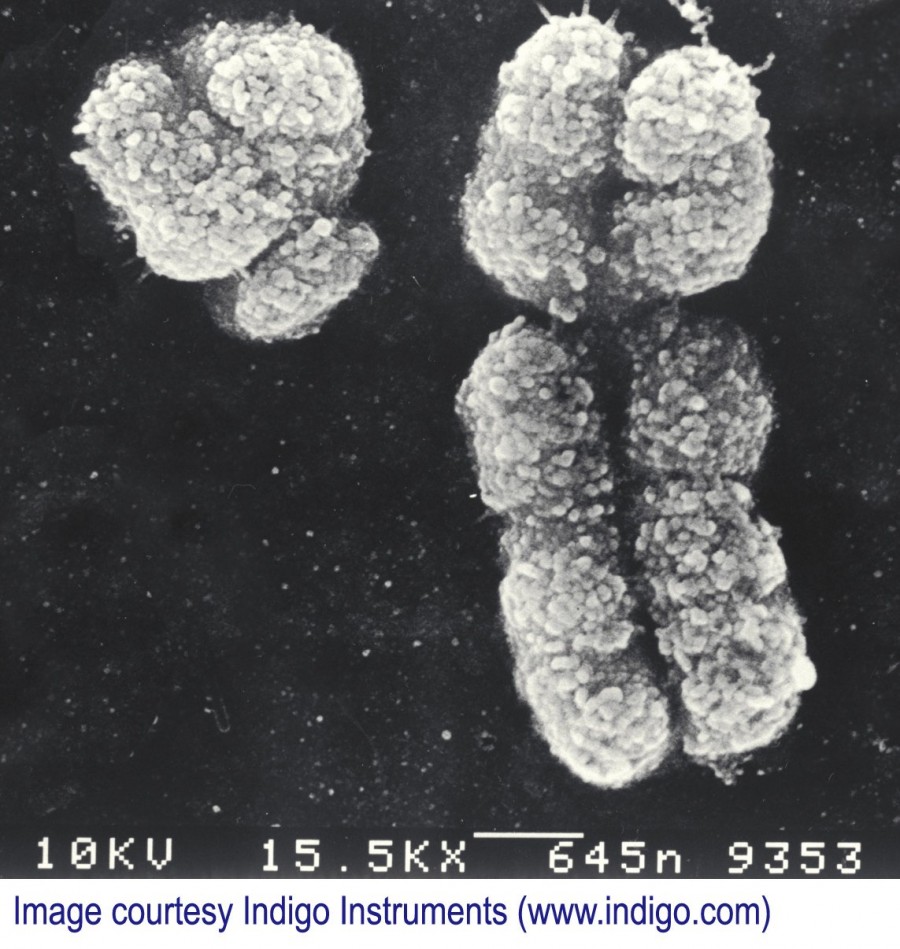 Y Kromozomunun Yok Olacağına Dair Fikirleri Çürüten Bir Çalışma