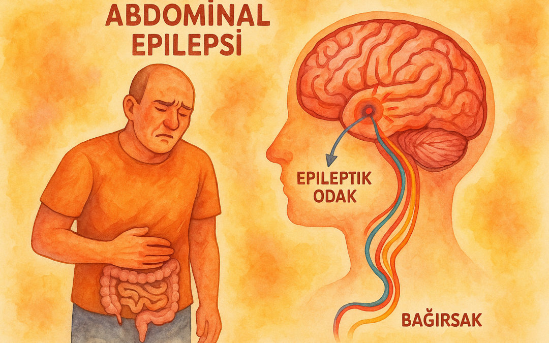 Abdominal epilepsi