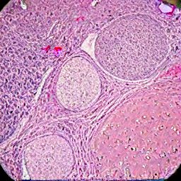 CDC tarafından yürütülen bir çalışma, çocuklarda görülen hepatit vakalarındaki artışa ilişkin ipuçları sunmayı amaçlıyor