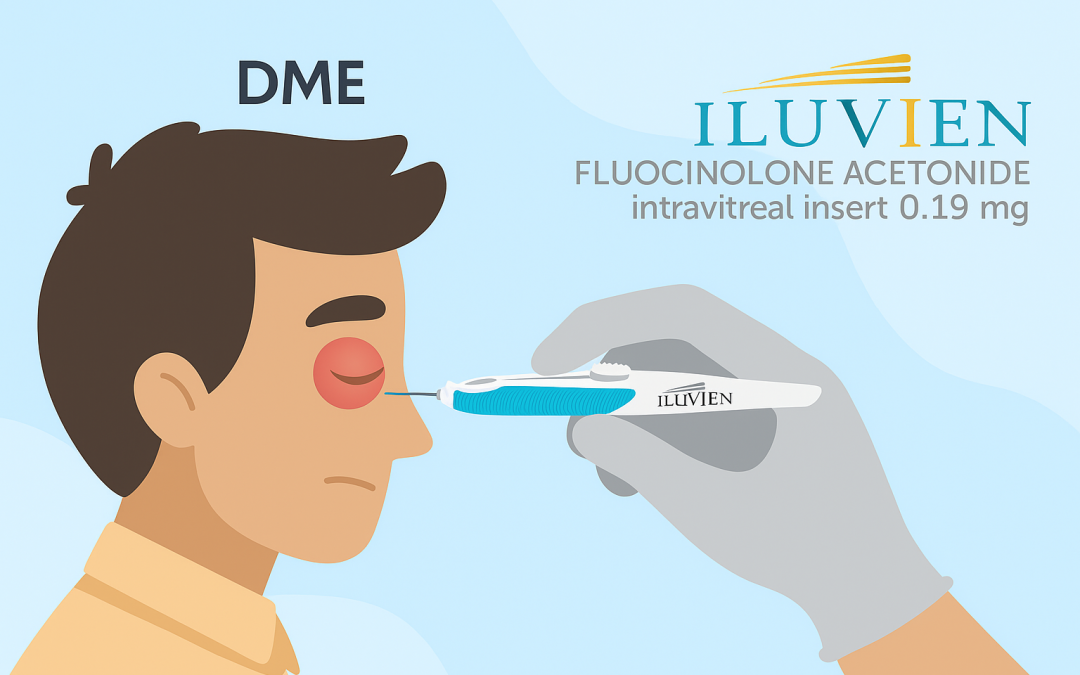 Fluocinolone acetonide (FA)